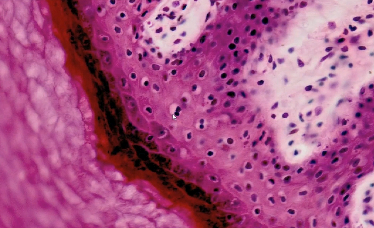 microscopic image of a histology slide